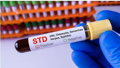 Перший досвід застосування в антенатальних клініках Києва швидких тестів для одночасного виявлення серологічних маркерів ВІЛ-інфекції та сифілісу